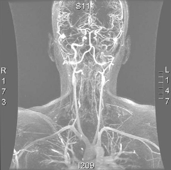 วิทย์ (ทด) ลองของ - แม่เหล็กบำบัด 2 magnet therapy02